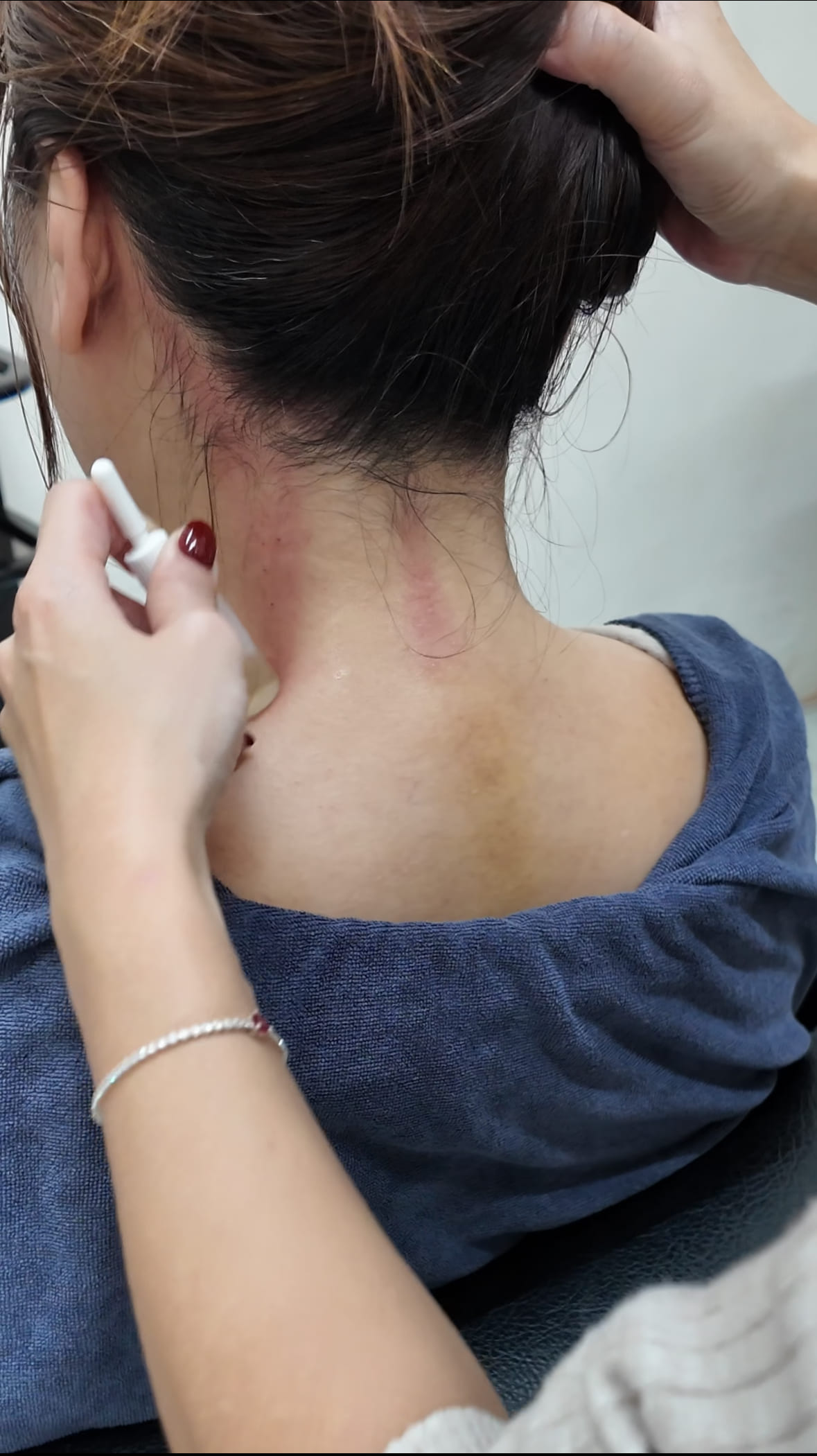 芸朵 MissMia頭皮護理-頭部刮痧